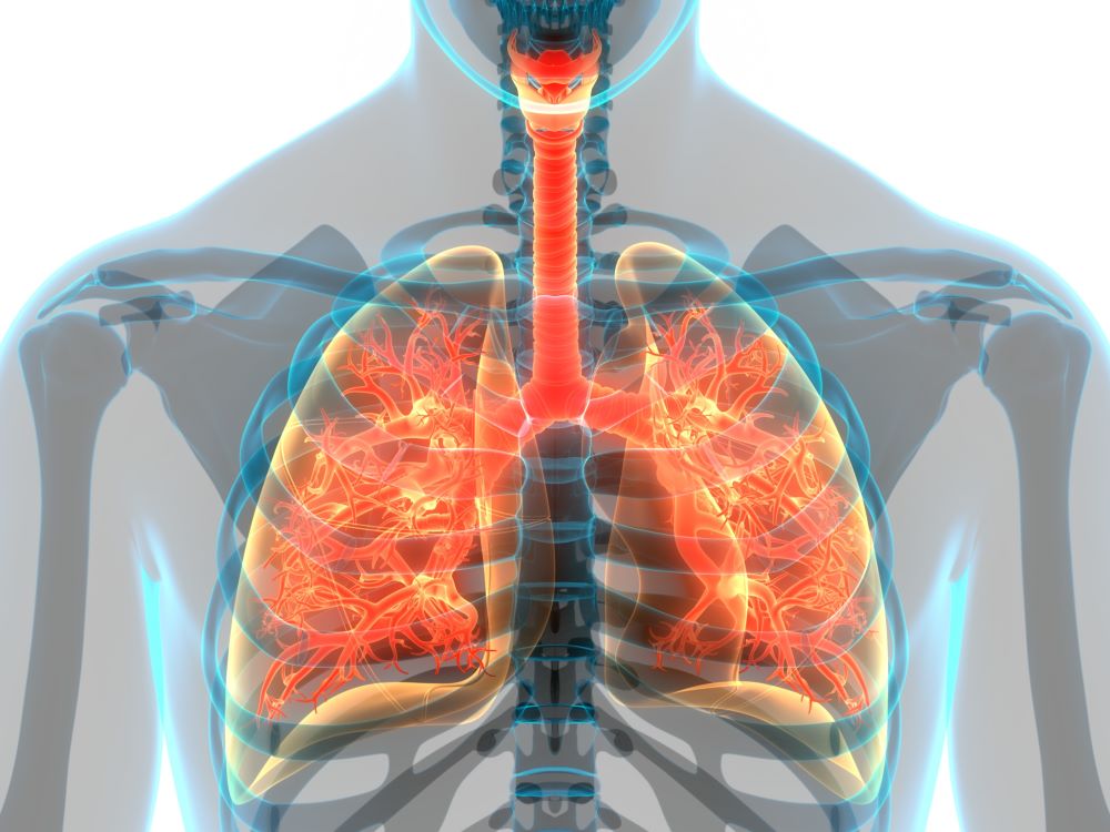 Foto del artículo: EBUS para diagnóstico de cáncer de pulmón