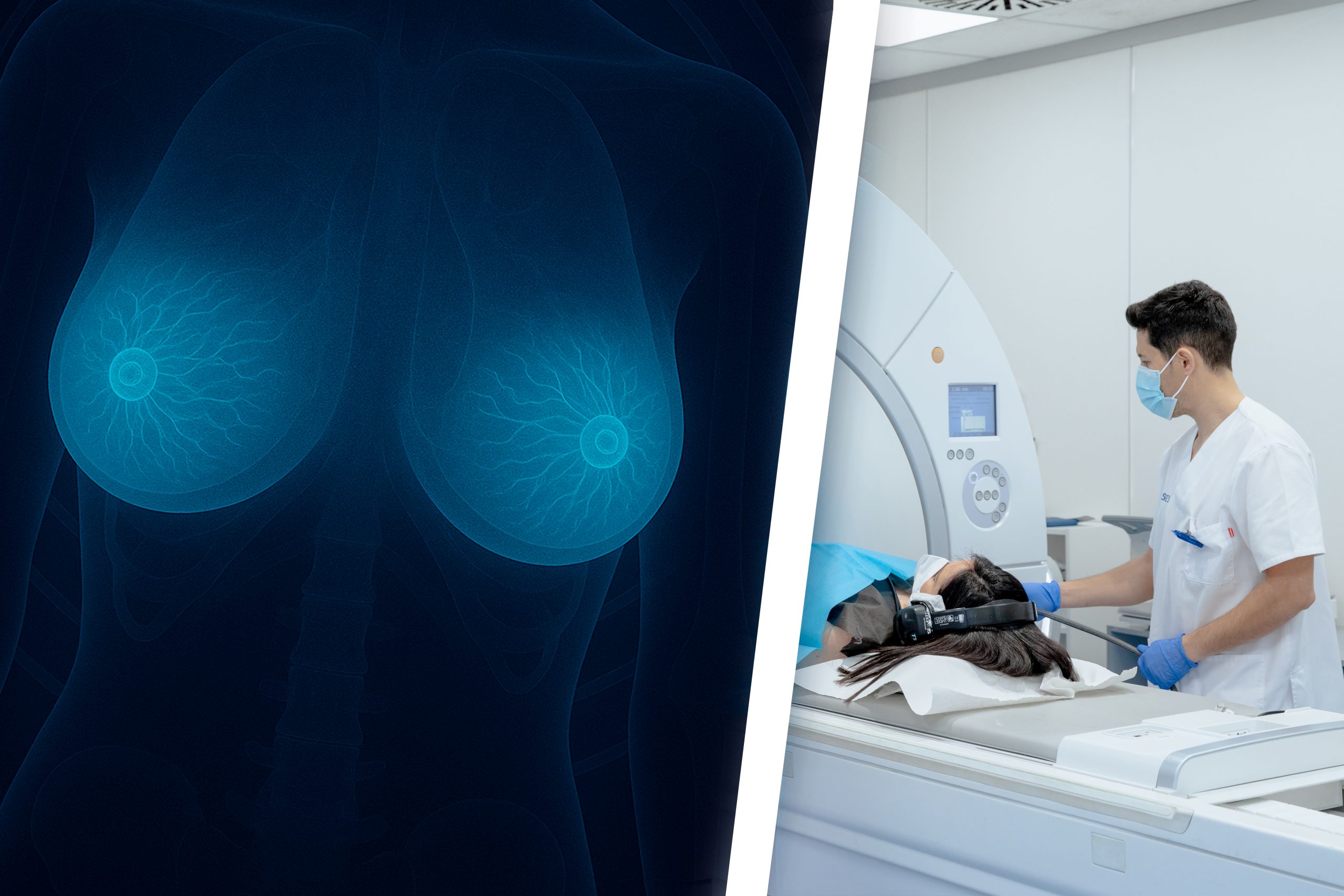 Foto del artículo: Resonancia Magnética de Mama