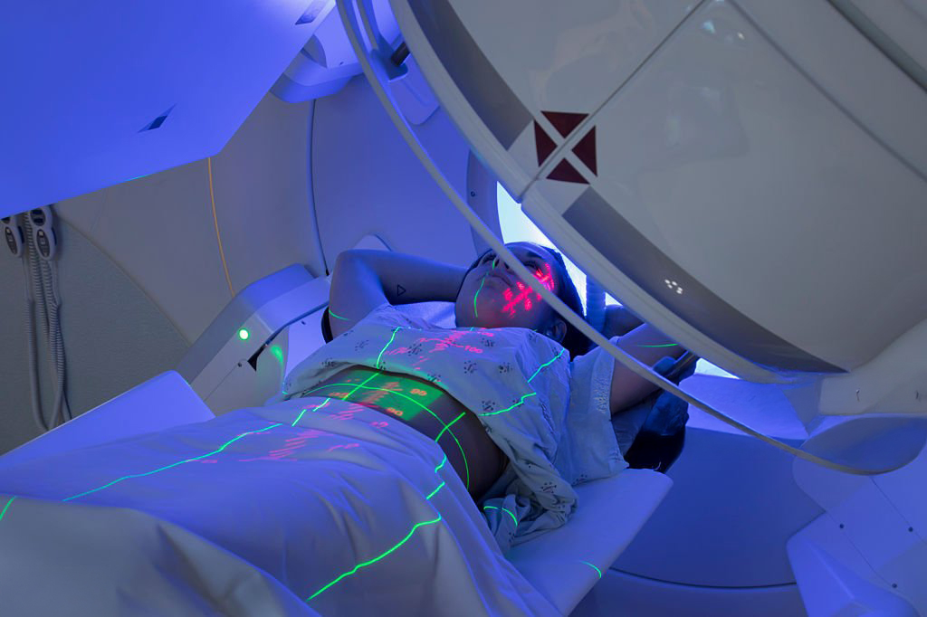 Foto del artículo:  Reducimos la radiación al paciente con BREATH HOLD y SBRT 