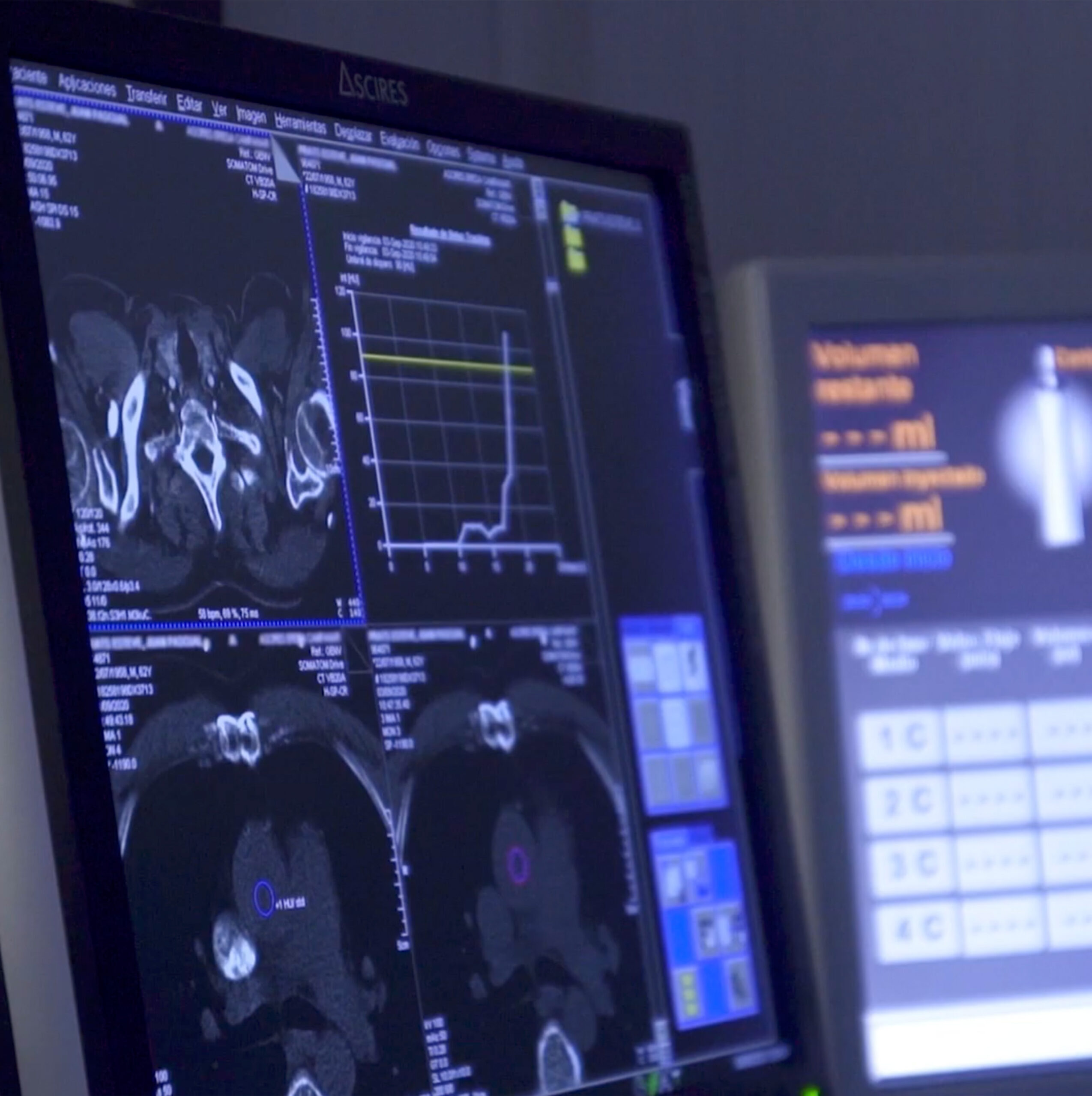 Foto del artículo: Detección precoz de alteraciones cardiovasculares 