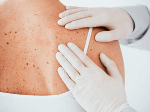 Foto del artículo: En Dermatología colaboramos con equipos multidisciplinares 