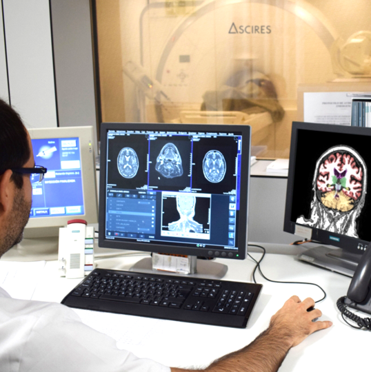 Foto del artículo: Pruebas de imagen apoyadas por inteligencia artificial 