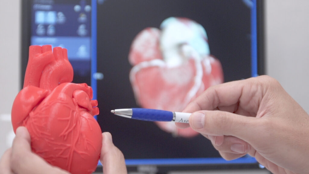 Mayor precisión diagnóstica para los pacientes
Este reconocimiento implica un nivel de calidad que supone importantes beneficios para los pacientes. En primer lugar, garantiza una mayor precisión diagnóstica por ser un centro que emplea “técnicas avanzadas que permiten mejorar la detección de la insuficiencia cardiaca,cardiopatía isquémica, cardiotoxicidad, miocardiopatías y valvulopatías”, como destaca la cardióloga Alicia Maceira, responsable del Servicio de Cardiología y directora médica de Ascires.   

Junto con su gran precisión diagnóstica,otra ventaja clara de la cardiorresonancia magnética es que se trata de una prueba no invasiva y sin radiación para el paciente. “También ayuda a identificar mejor a los pacientes con mayor riesgo y seleccionar los tratamientos más adecuados en cada caso”, indica la doctora Maceira.

Detectar perfiles de riesgo
Según los datos del Instituto Nacional de Estadística (INE), las muertes por enfermedades del sistema circulatorio descendieron un 2,4% en 2024, pero siguen siendo la primera causa de fallecimiento en hombres y la segunda en mujeres. Los expertos señalan los hábitos de vida saludable y las revisiones cardiológicas como dos pilares fundamentales para prevenir las enfermedades del corazón.

El control de los factores de riesgo -sedentarismo, tabaquismo, hipertensión, colesterol y obesidad, entre otros- siempre es clave, pero hay perfiles de pacientes o etapas de la vida en los que las revisiones cobran una mayor importancia para anticiparse a los problemas cardiovasculares. “Determinados grupos de población como son los familiares de pacientes con cardiopatías o los pacientes con múltiples factores de riesgo cardiovascular y patologías asociadas pueden tener patrones de riesgo complejos y requerir un seguimiento más cercano”, señala la especialista.

Labor investigadora
Los centros acreditados a nivel europeo, como Ascires, cuentan con facultativos certificados para informar las pruebas diagnósticas y personal muy entrenado para realizar estos estudios.

“Nuestros cardiólogos disponen de las máximas certificaciones individuales de la Asociación Europea de Imagen Cardiovascular (Sociedad Europea de Cardiología) en cardiorresonancia magnética, cardiotomografía computarizada y ecocardiografía. Además, desarrollamos una intensa labor investigadora con participación en estudios internacionales y programas de formación continua”, señala la dra. Maceira. Cardiopatía isquémica, cardiología deportiva o insuficiencia cardiaca son algunos de los ámbitos en los que el equipo Ascires ha centrado sus últimas investigaciones científicas _ IMAGEN CORAZÓN