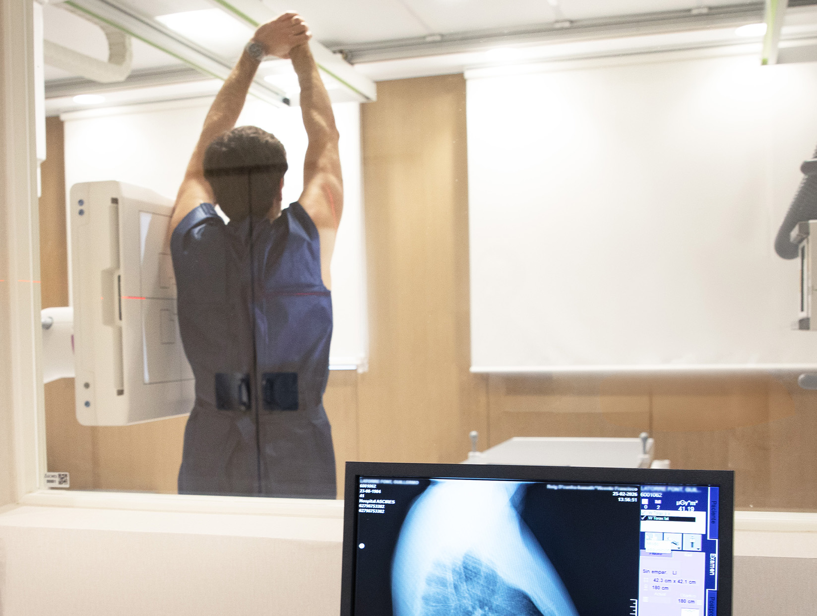 Foto del artículo: Técnica de fluoroscopia para imágenes en movimiento 