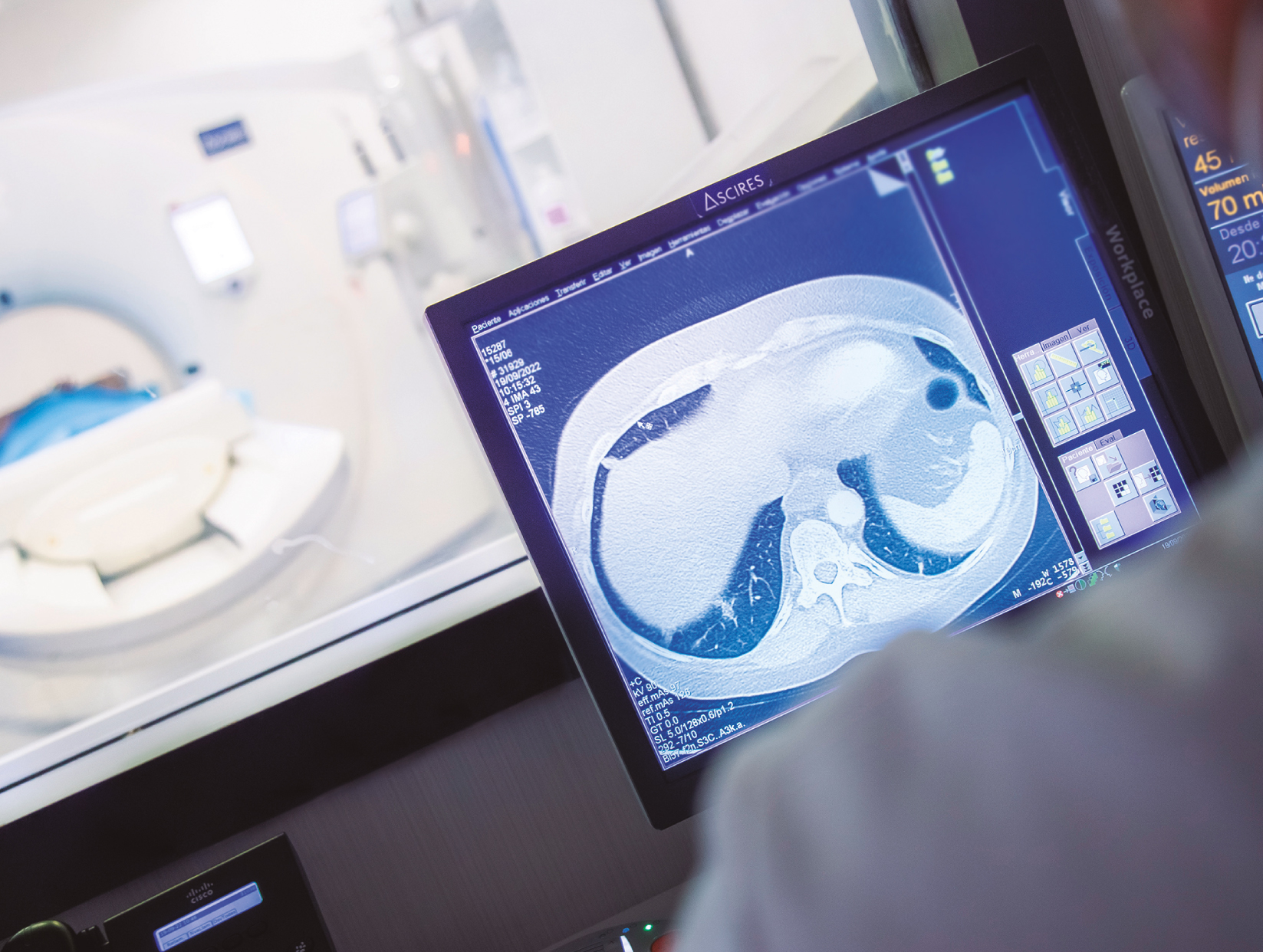 Foto del artículo: Tomografía Computarizadas (TC o TAC)